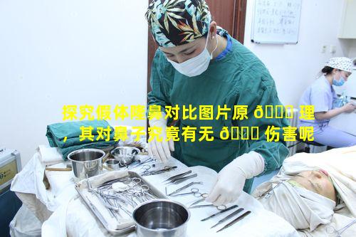 探究假体隆鼻对比图片原 🐒 理，其对鼻子究竟有无 🍀 伤害呢